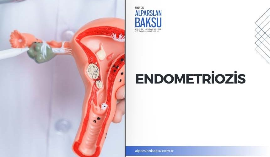 endometriozis, alparslan baksu